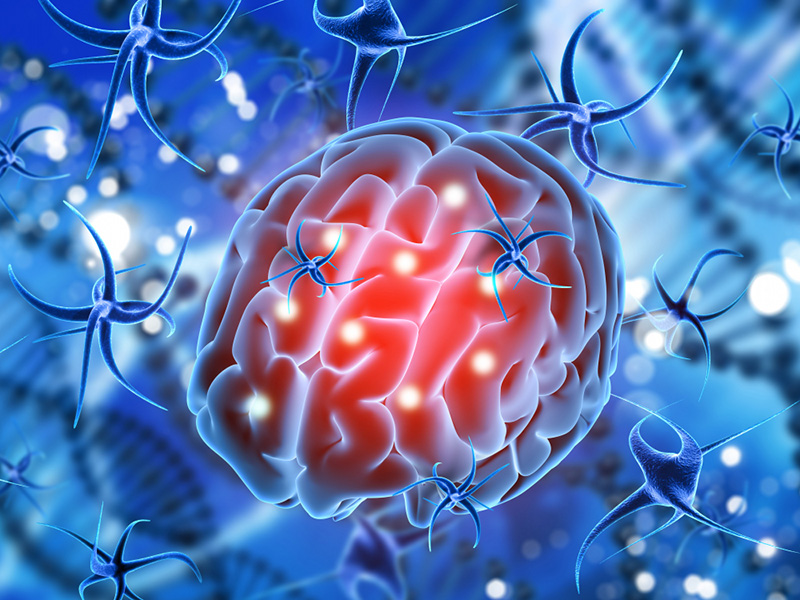 3D medical animation project